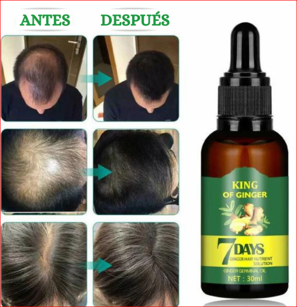 CRECIMIENTO CAPILAR EN SPRAY - TRATAMIENTO PARA EL CRECIMIENTO Y PERDIDA DEL CABELLO